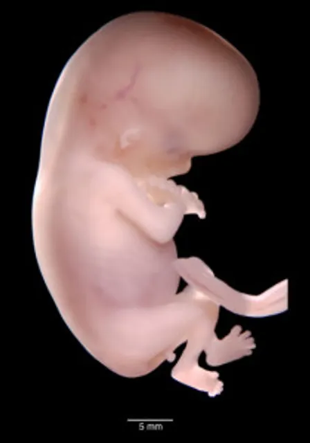 Ultralyd uke 10–11